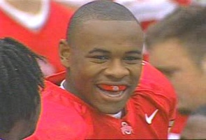 Ted Ginn bit as a pup in 2004 Ted Ginn bit as a pup in 2004