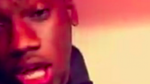 Torrance Gibson, After Dentist
