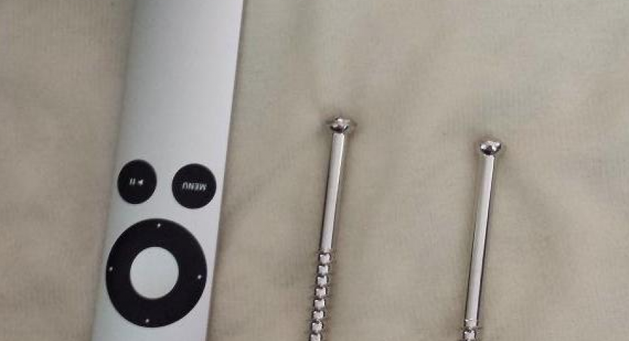 Kyle Berger's Leg-Screws