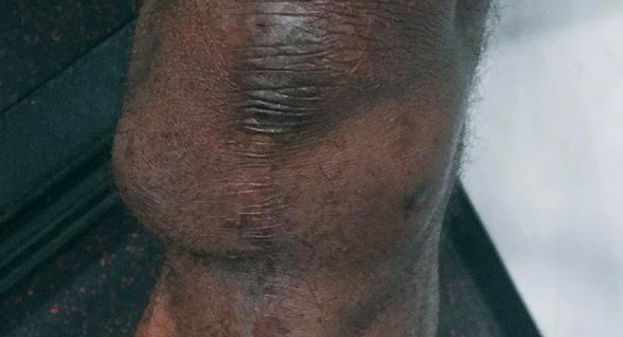 LeCharles Bentley's knee.